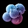 B0003402 Early human embryo